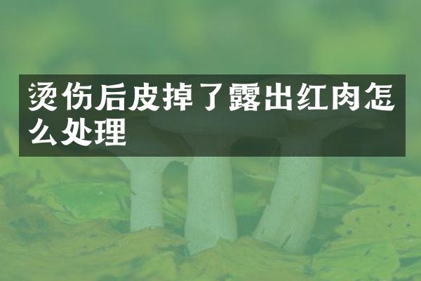 烫伤后皮掉了露出红肉怎么处理