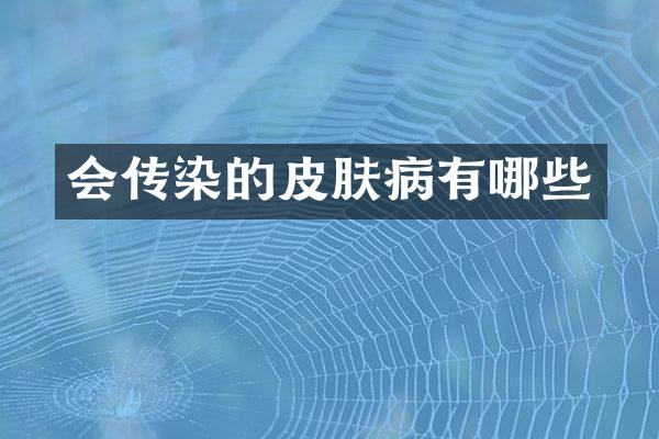 会传染的皮肤病有哪些